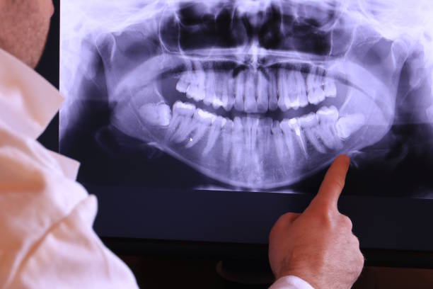 Best Pediatric Emergency Dentist in Garden City, NY
